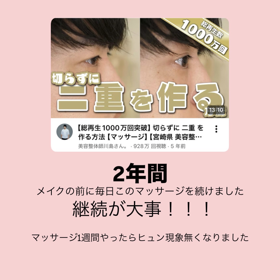 のびーるアイテープ（絆創膏タイプ、レギュラー）/DAISO/二重まぶた用アイテムを使ったクチコミ（3枚目）