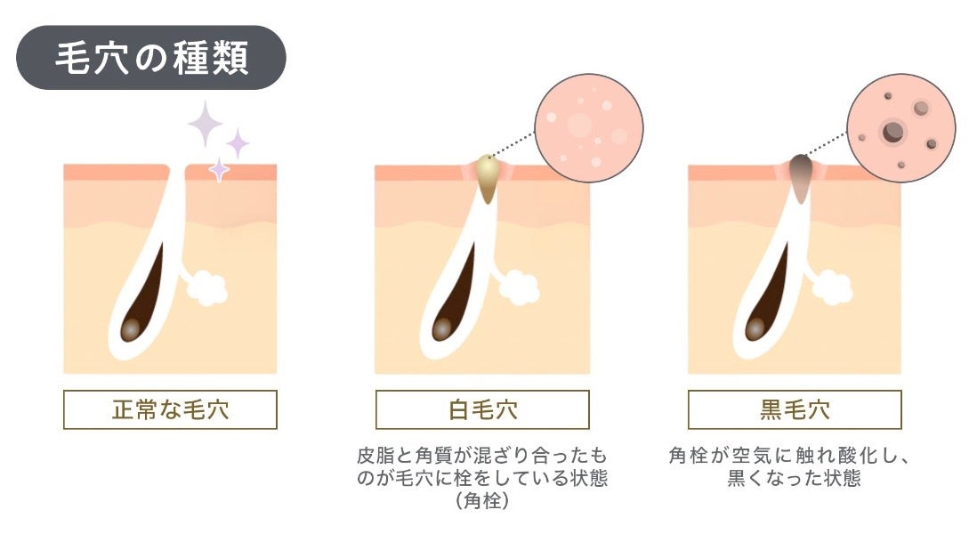 ゼロ毛穴クレイパック/MEDICUBE/洗い流すパック・マスクを使ったクチコミ(5枚目)