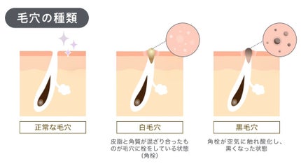 ゼロ毛穴クレイパック/MEDICUBE/洗い流すパック・マスクを使ったクチコミ(5枚目)