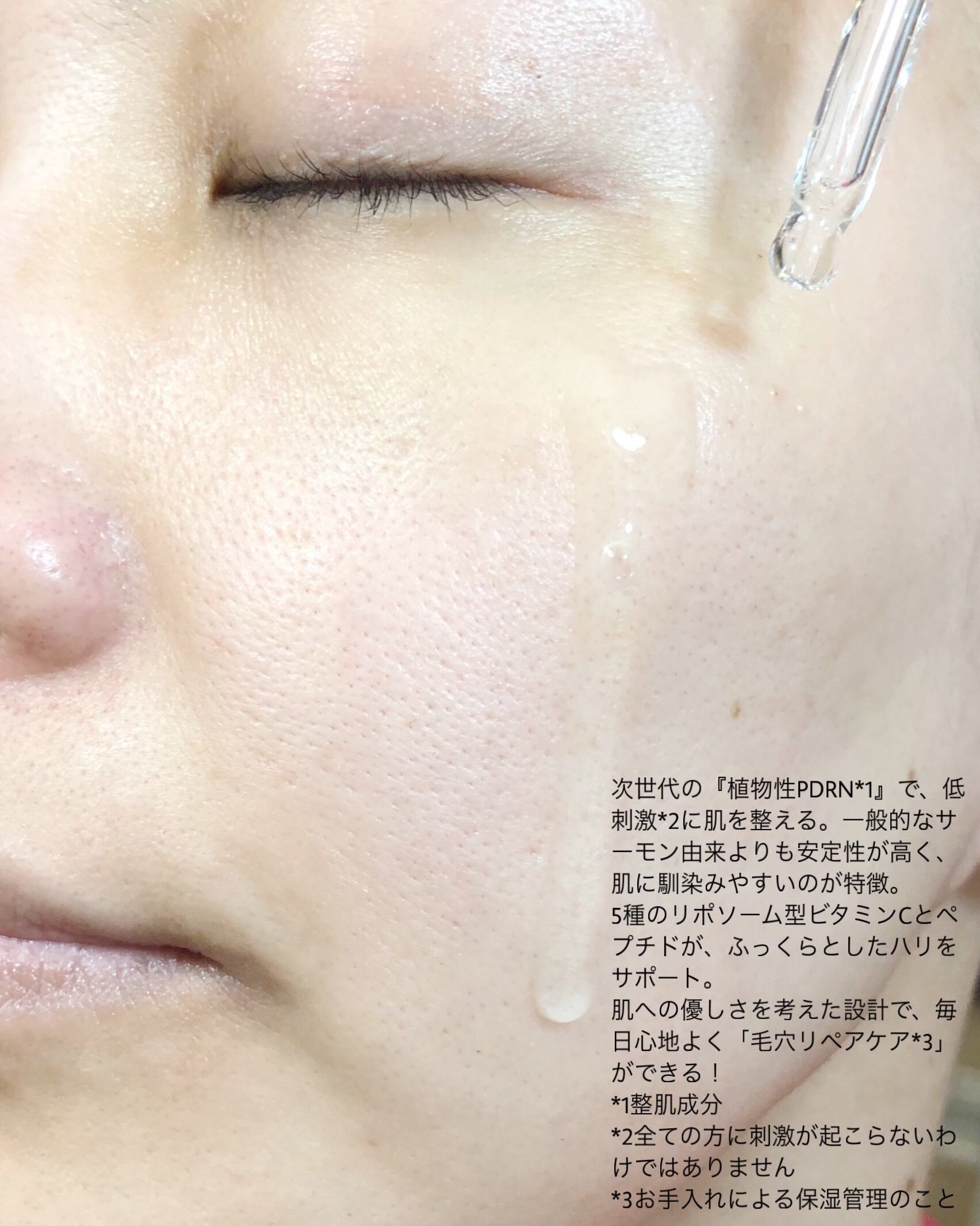 PDRNビタペプチド毛穴リペアセラム/Klairs/美容液を使ったクチコミ（3枚目）
