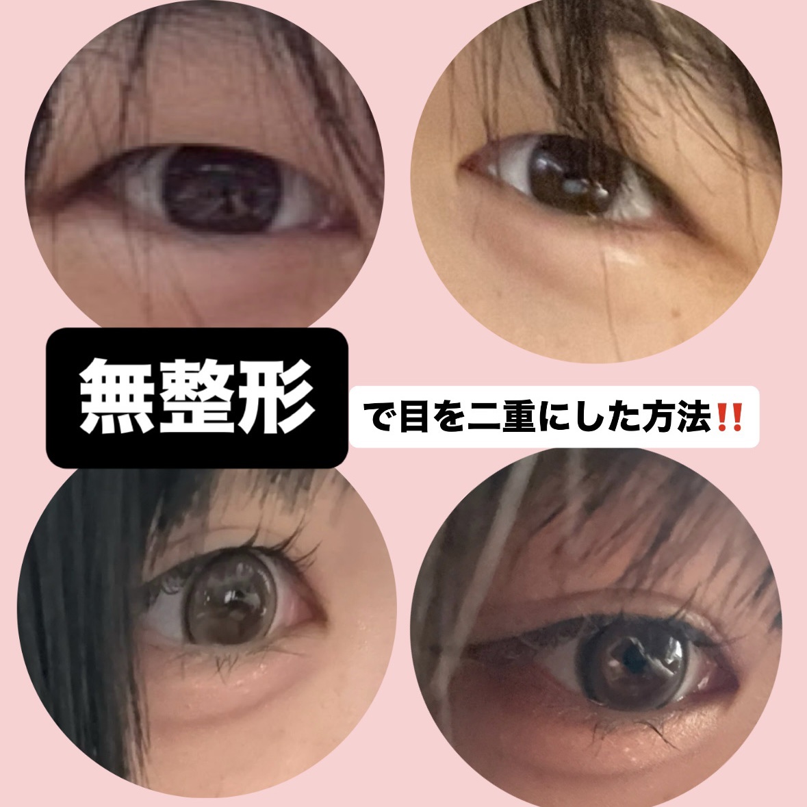 のびーるアイテープ（絆創膏タイプ、レギュラー）/DAISO/二重まぶた用アイテムを使ったクチコミ（1枚目）