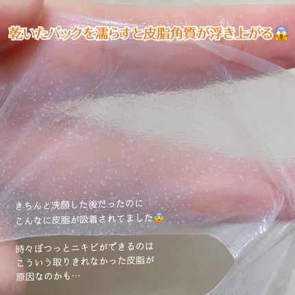 トラブルパッチマスク/EIOM/その他スキンケアを使ったクチコミ(3枚目)