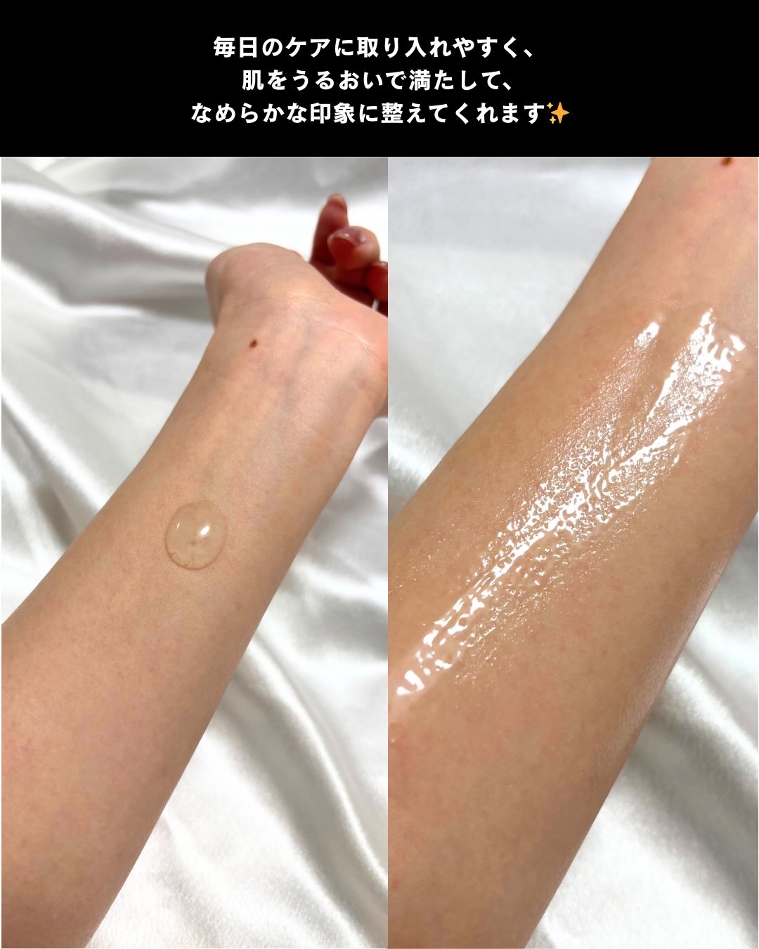 ブレミッシュケアアップ セラム/ISOI/美容液を使ったクチコミ（3枚目）