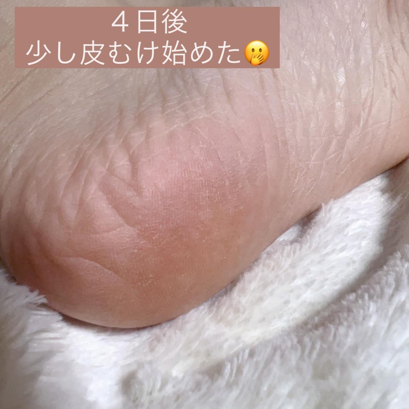 エブリユー 足裏角質/EVERYYOU/レッグ・フットケアを使ったクチコミ(5枚目)