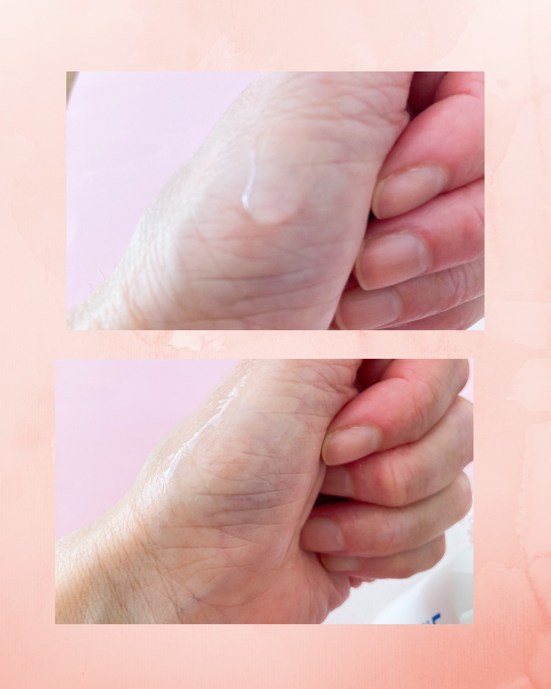 リポピールセラム/LIPOPEEL/美容液を使ったクチコミ（3枚目）