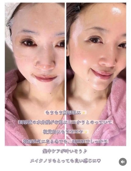 PDRN リフティングマスク/MEDIHEAL/シートマスク・パックを使ったクチコミ(3枚目)