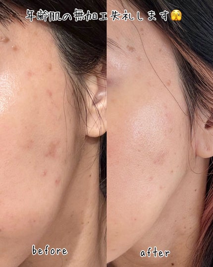 ハイドロキノンクリーム6%/KITEN/フェイスクリームを使ったクチコミ(2枚目)