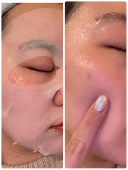 ティーツリー エッセンシャルマスクカーミングモイスチャー/MEDIHEAL/シートマスク・パックを使ったクチコミ（3枚目）