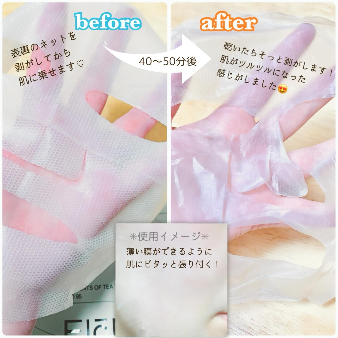 トラブルパッチマスク/EIOM/その他スキンケアを使ったクチコミ（2枚目）