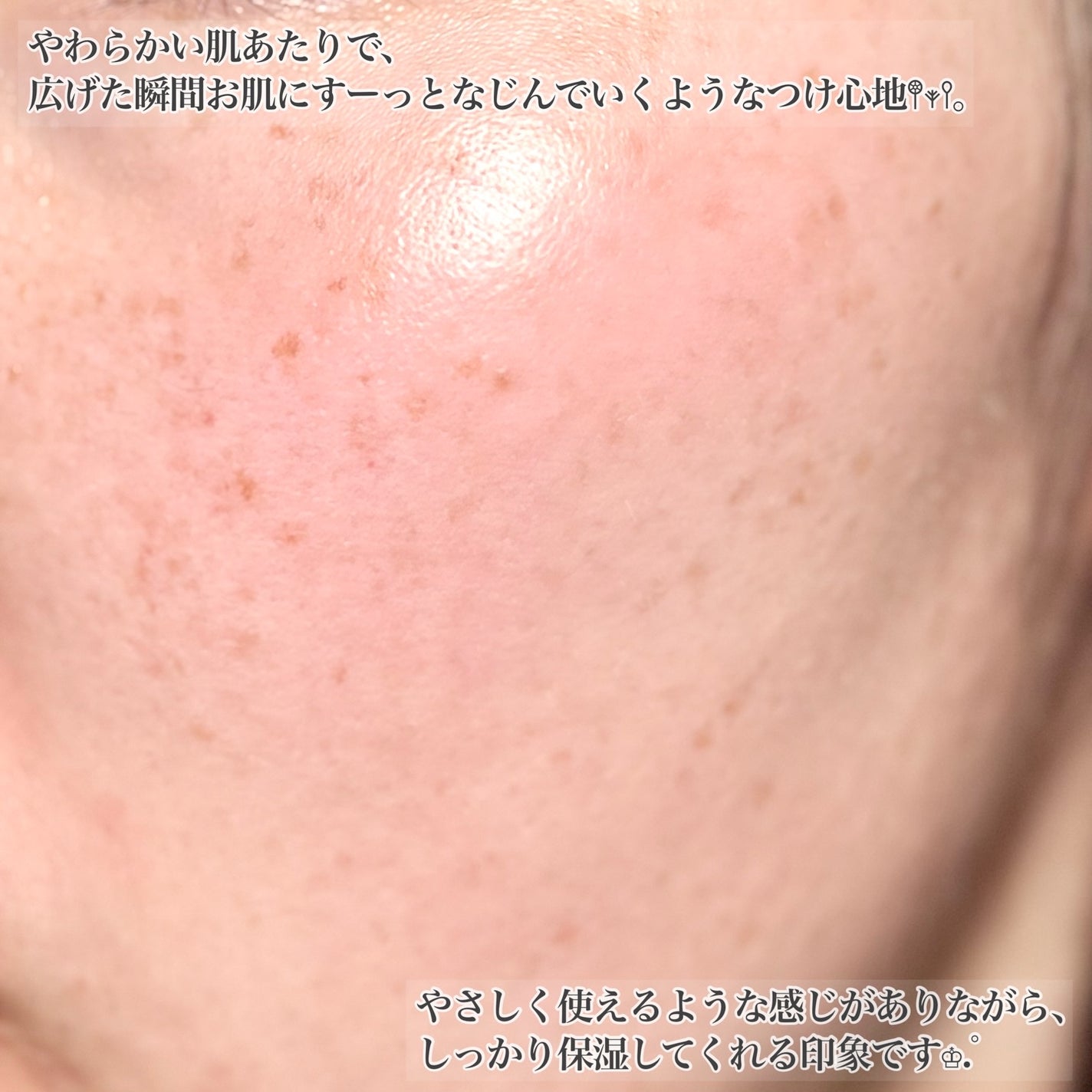 ラバ・シーウォーター水分密着アンプルエッセンス/Milba Lab/美容液を使ったクチコミ(5枚目)