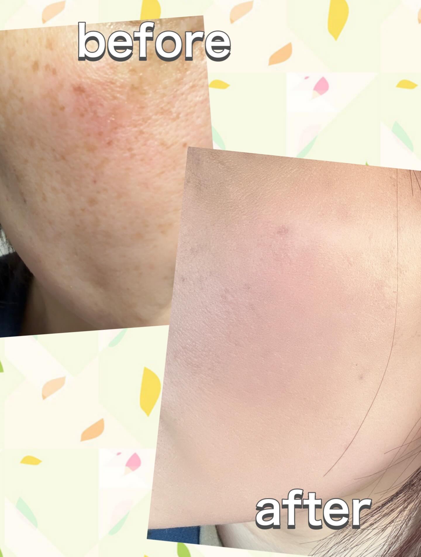 ベルベットジュエルクッション/BIVABOO/クッションファンデーションを使ったクチコミ（3枚目）