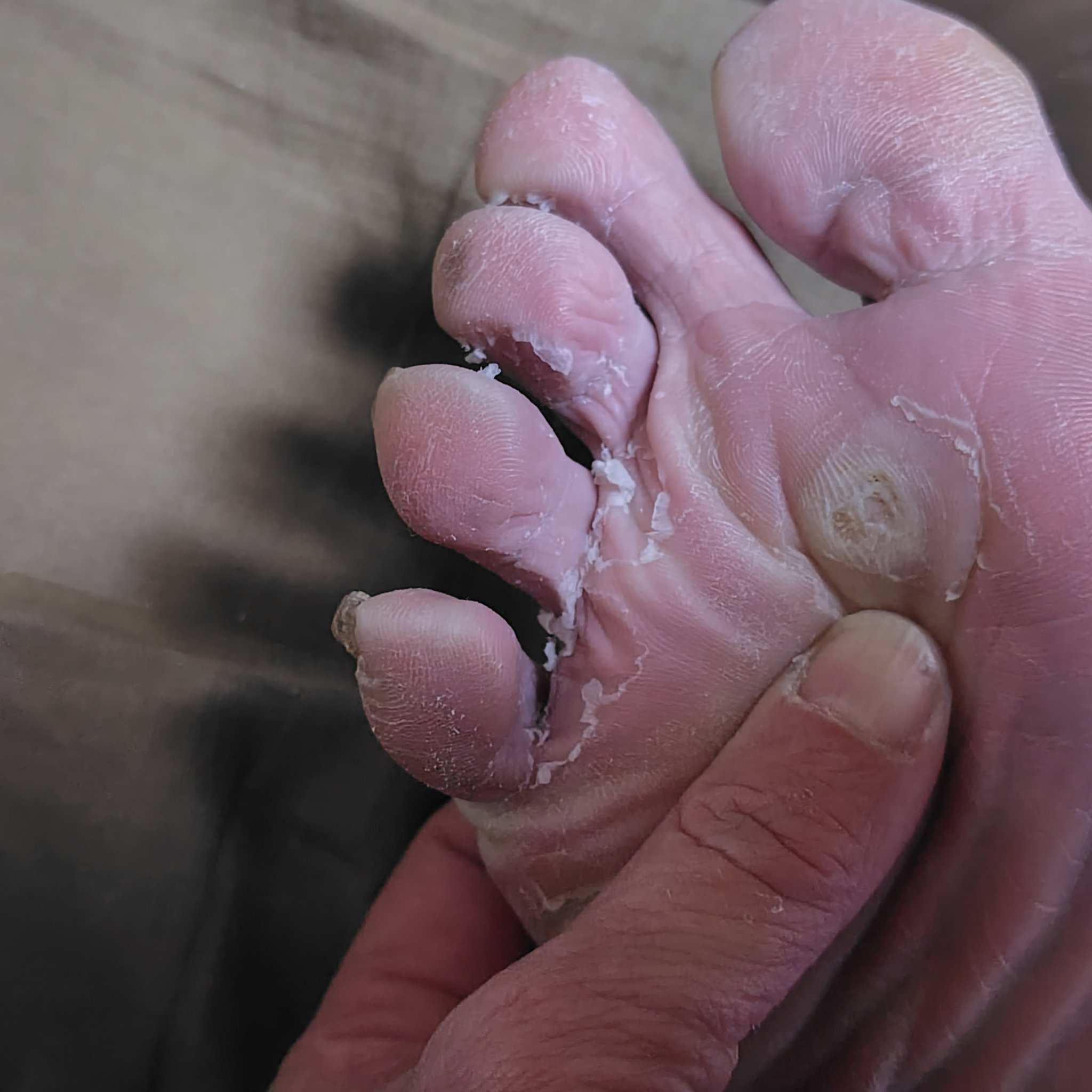 イージーパックDP60分タイプ/ベビーフット/レッグ・フットケアを使ったクチコミ（3枚目）