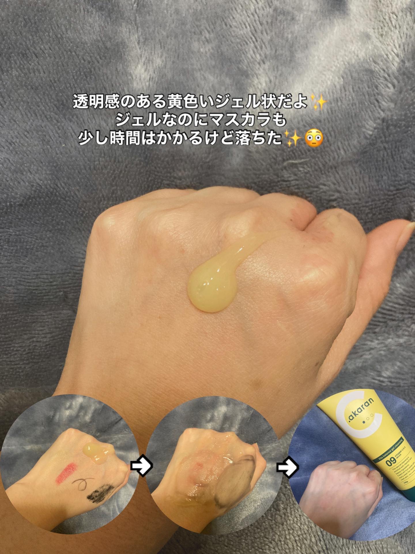 ビタバランスジェルクレンジング/.akaran/クレンジングジェルを使ったクチコミ（2枚目）