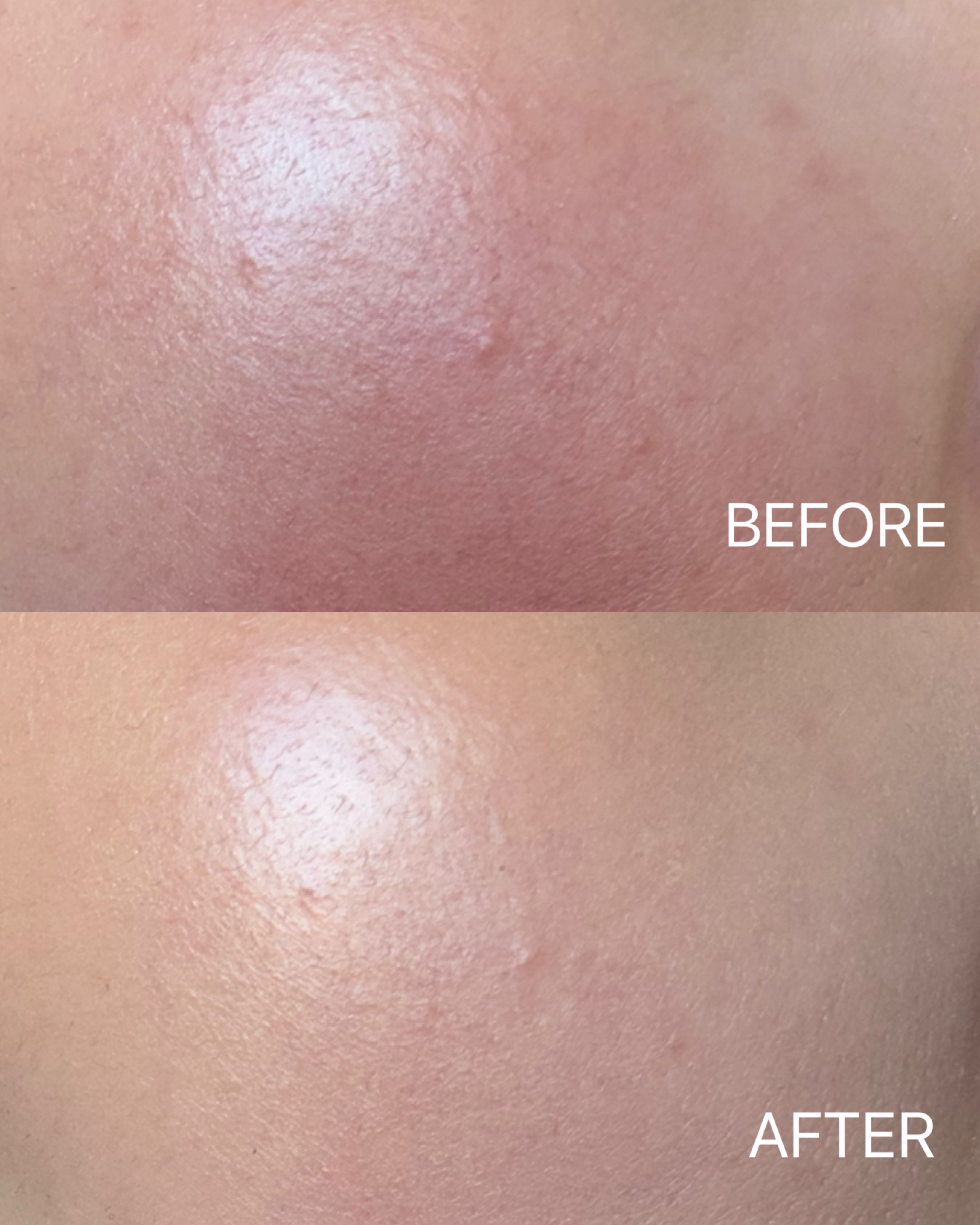 クリームファンデーションN＜ミニ＞/media/クリーム・エマルジョンファンデーションを使ったクチコミ（2枚目）