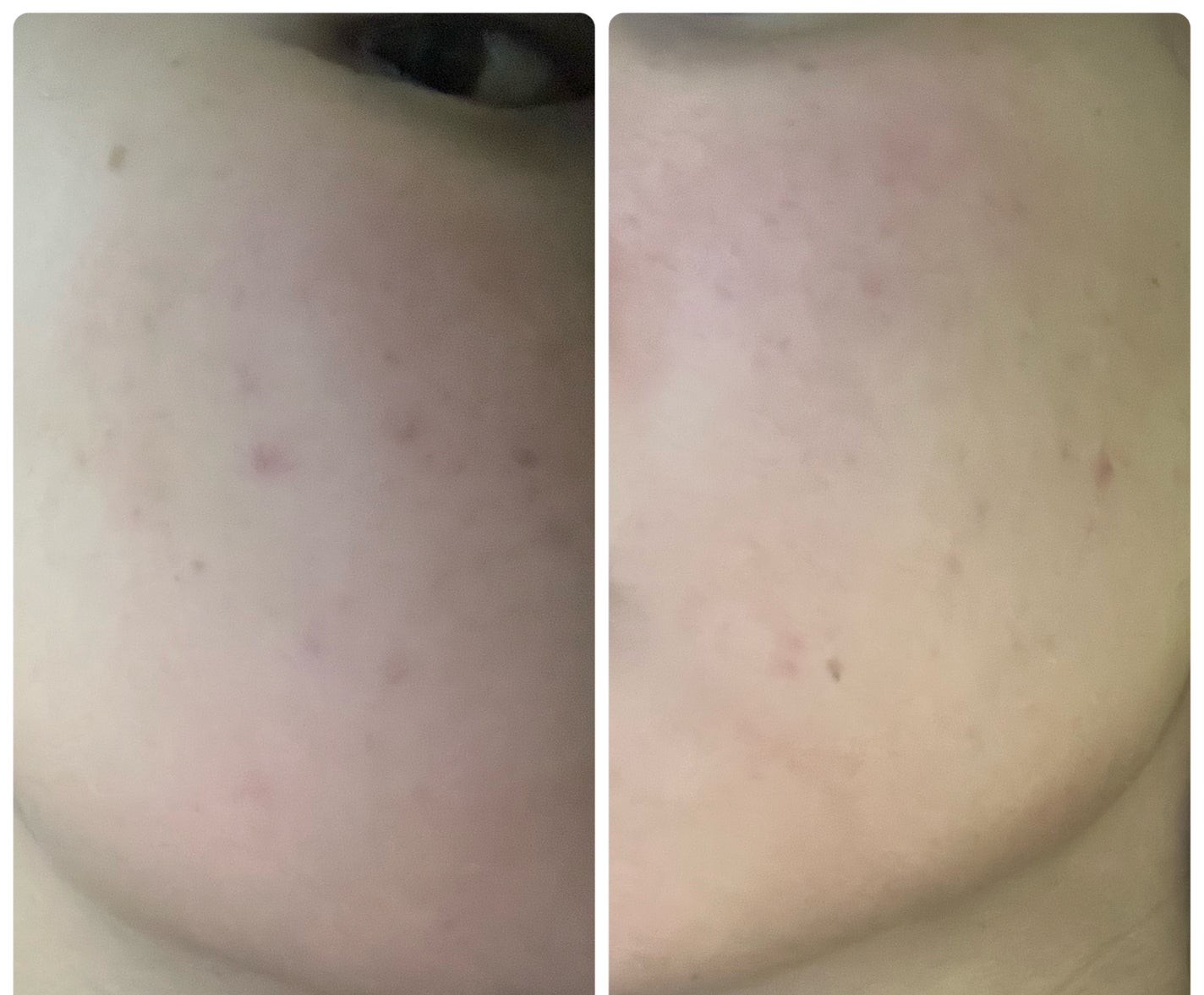 ぽむ on LIPS 「1枚目 2026.1.26エピデュオ 866日目2枚目 202..」(2枚目)