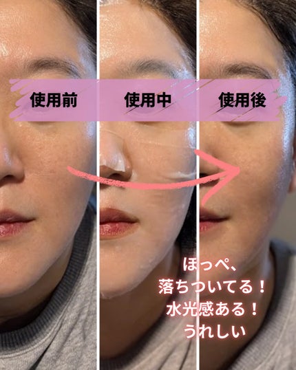 PDRN リフティングマスク/MEDIHEAL/シートマスク・パックを使ったクチコミ(3枚目)