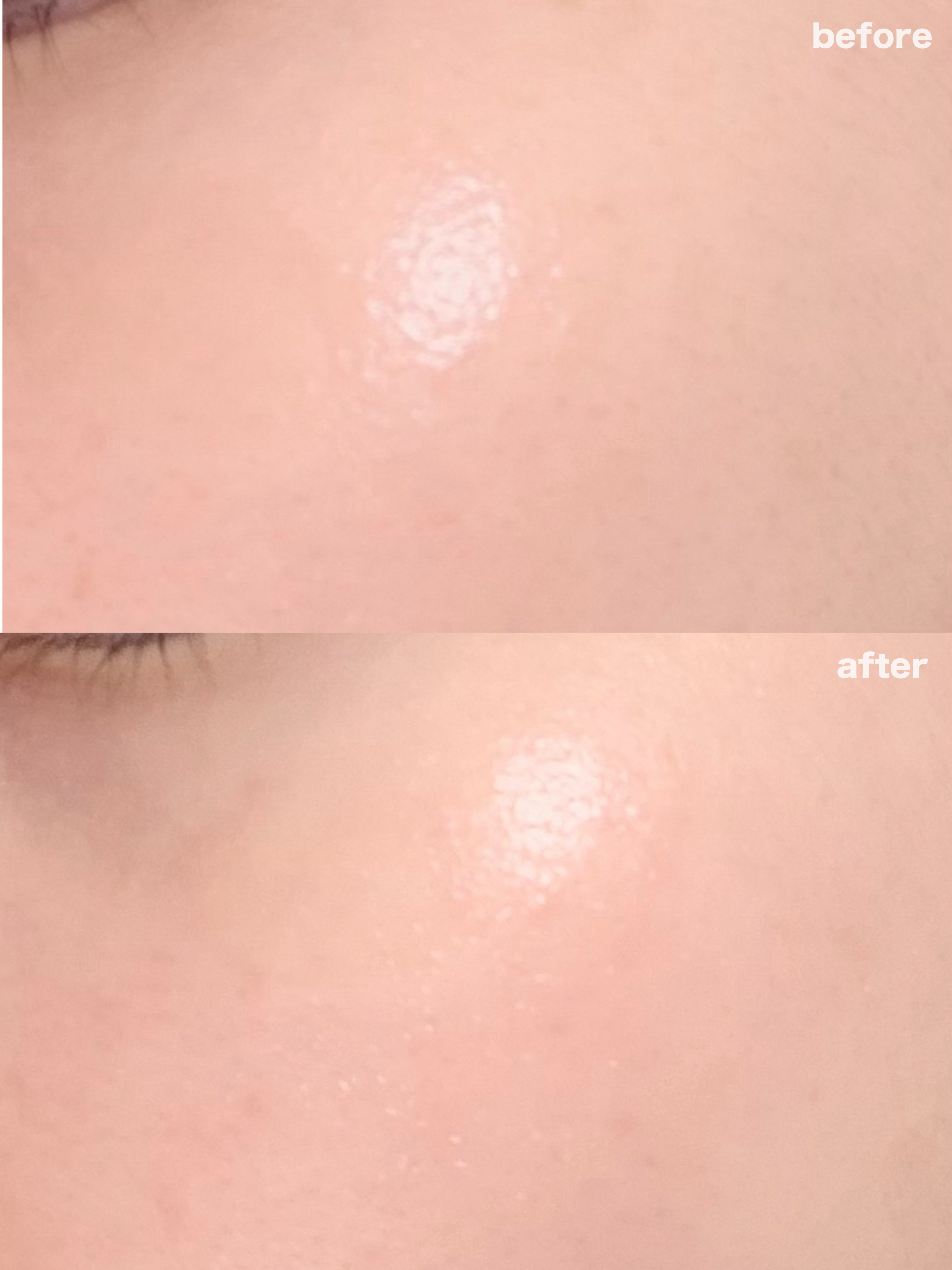 グルタチオンビタシートマスク デイリーピック/Abib /シートマスク・パックを使ったクチコミ（2枚目）