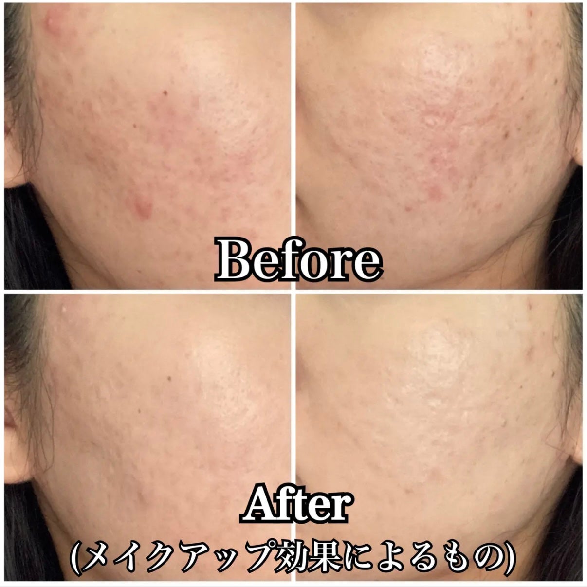 カバーアッププロコンシーラー/TFIT/パレットコンシーラーを使ったクチコミ(5枚目)