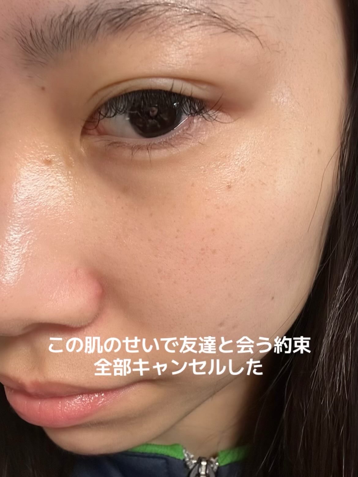 345リリーフクリーム/Dr.Althea/フェイスクリームを使ったクチコミ（1枚目）