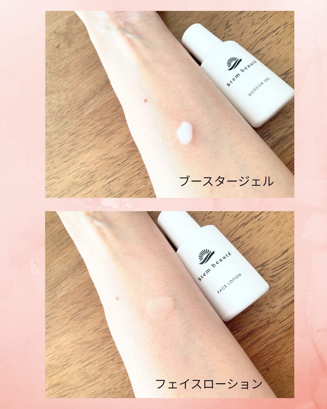 New Trial set/ステムボーテ/トライアルキットを使ったクチコミ（3枚目）