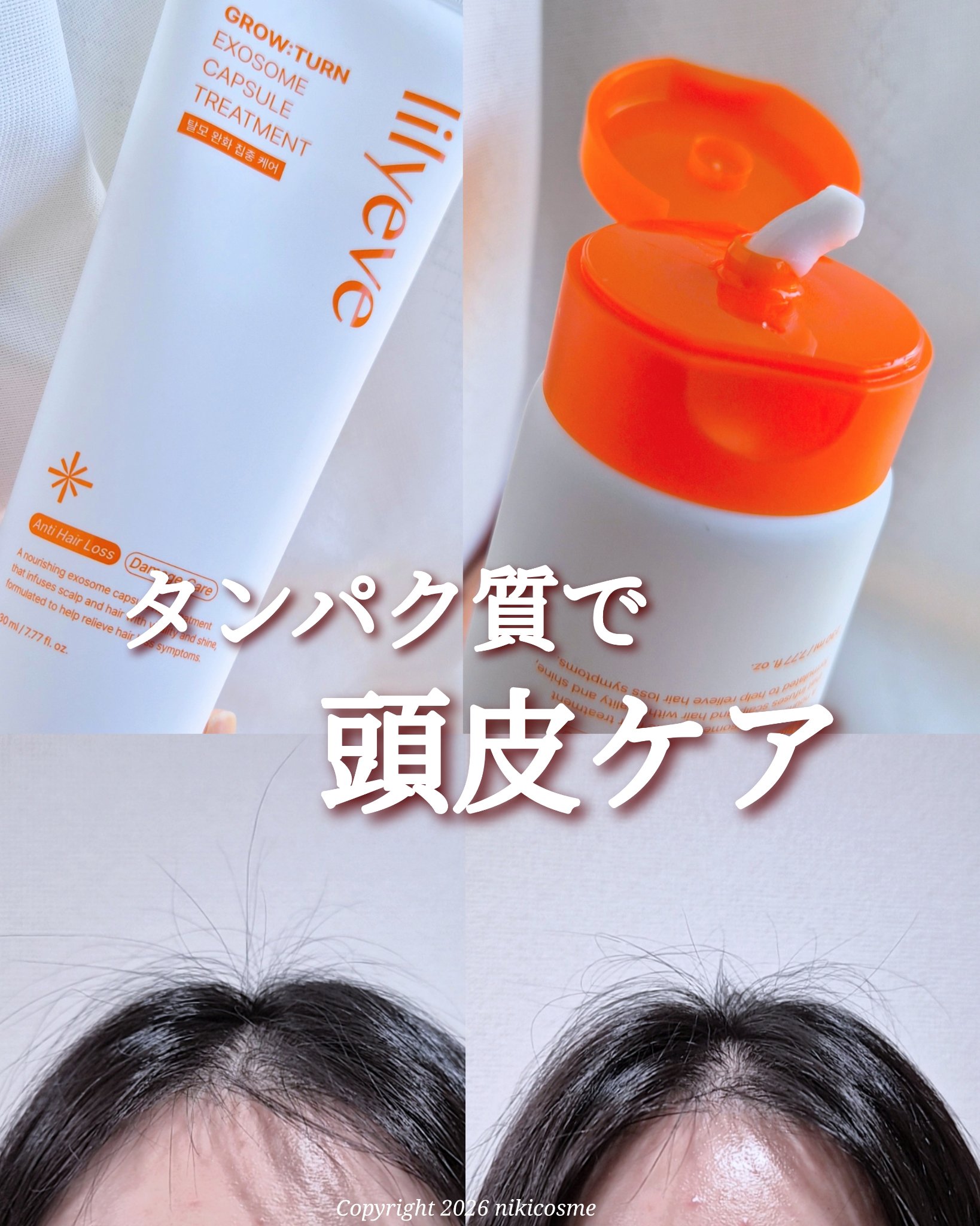 グローターン エクソソーム カプセル トリートメン/リリーイブ/洗い流すヘアトリートメントを使ったクチコミ（1枚目）