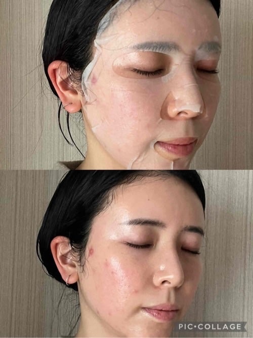 ローゼPDRNエッセンシャルマスクヘルシーグロウ/MEDIHEAL/シートマスク・パックを使ったクチコミ(4枚目)