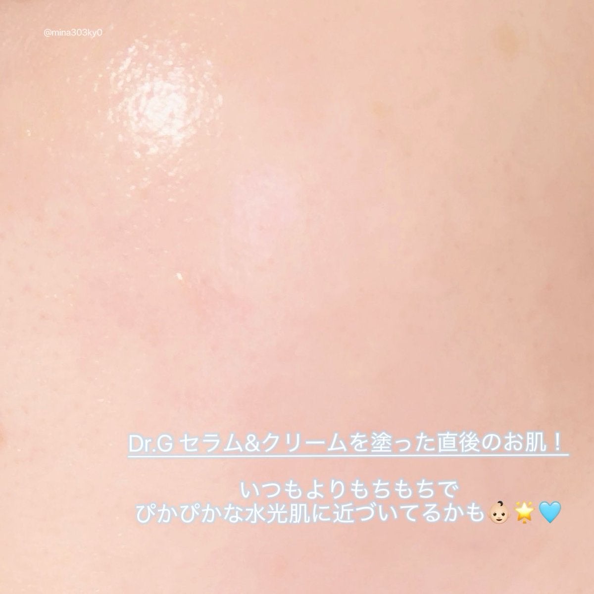 レッドブレミッシュ クリアスージングクリーム/Dr.G/フェイスクリームを使ったクチコミ（3枚目）