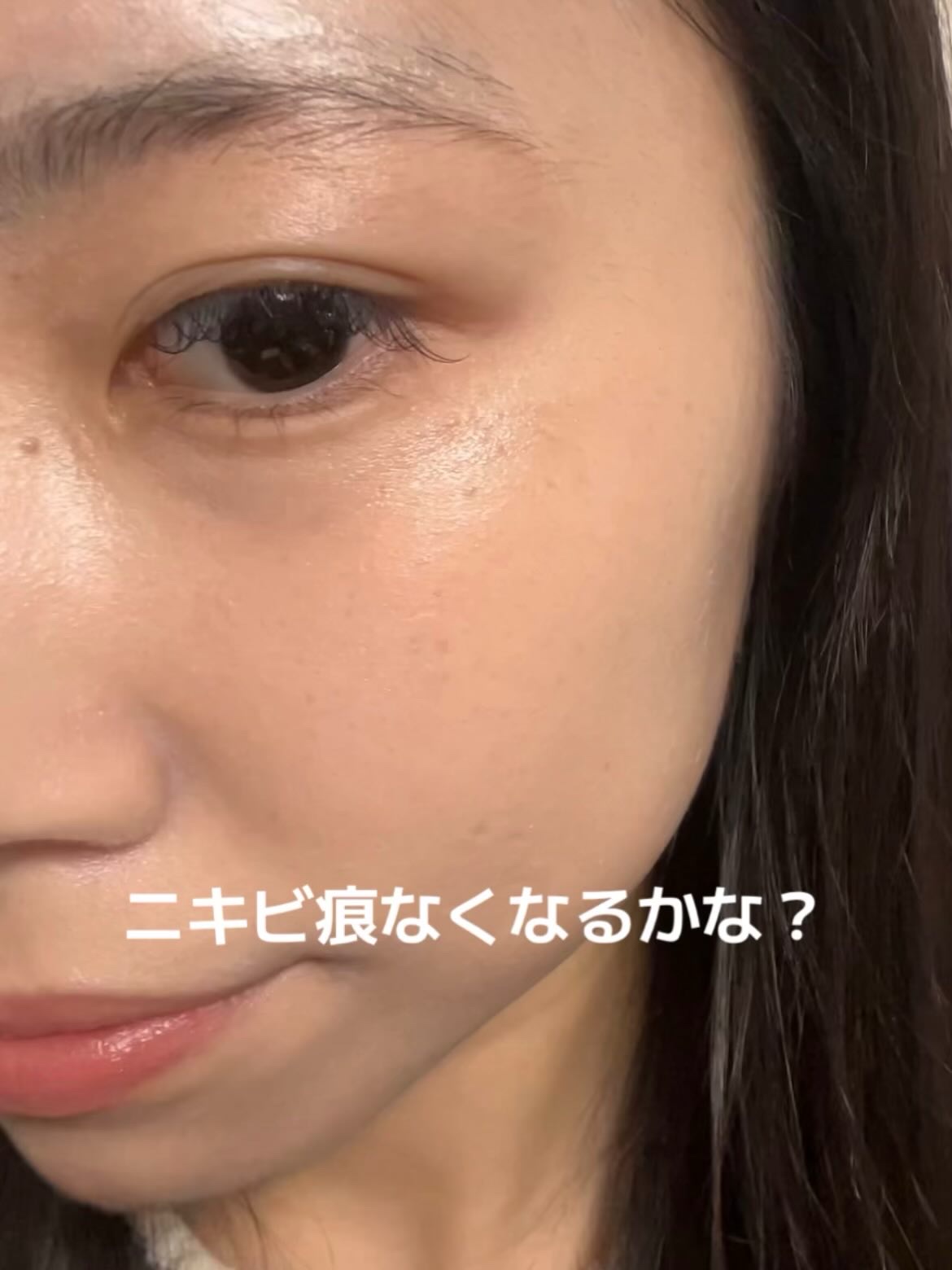 345リリーフクリーム/Dr.Althea/フェイスクリームを使ったクチコミ（3枚目）