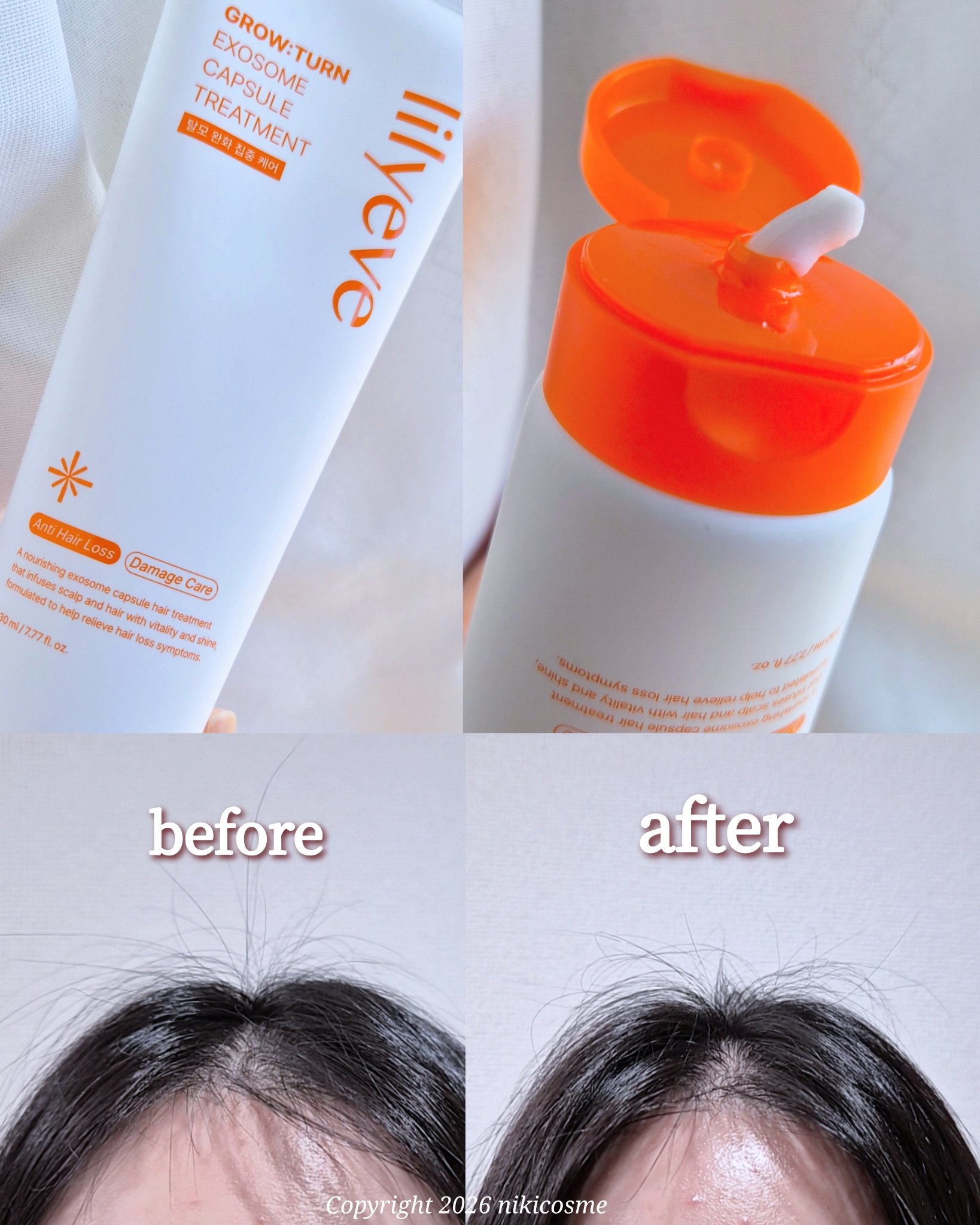 グローターン エクソソーム カプセル トリートメン/リリーイブ/洗い流すヘアトリートメントを使ったクチコミ（2枚目）