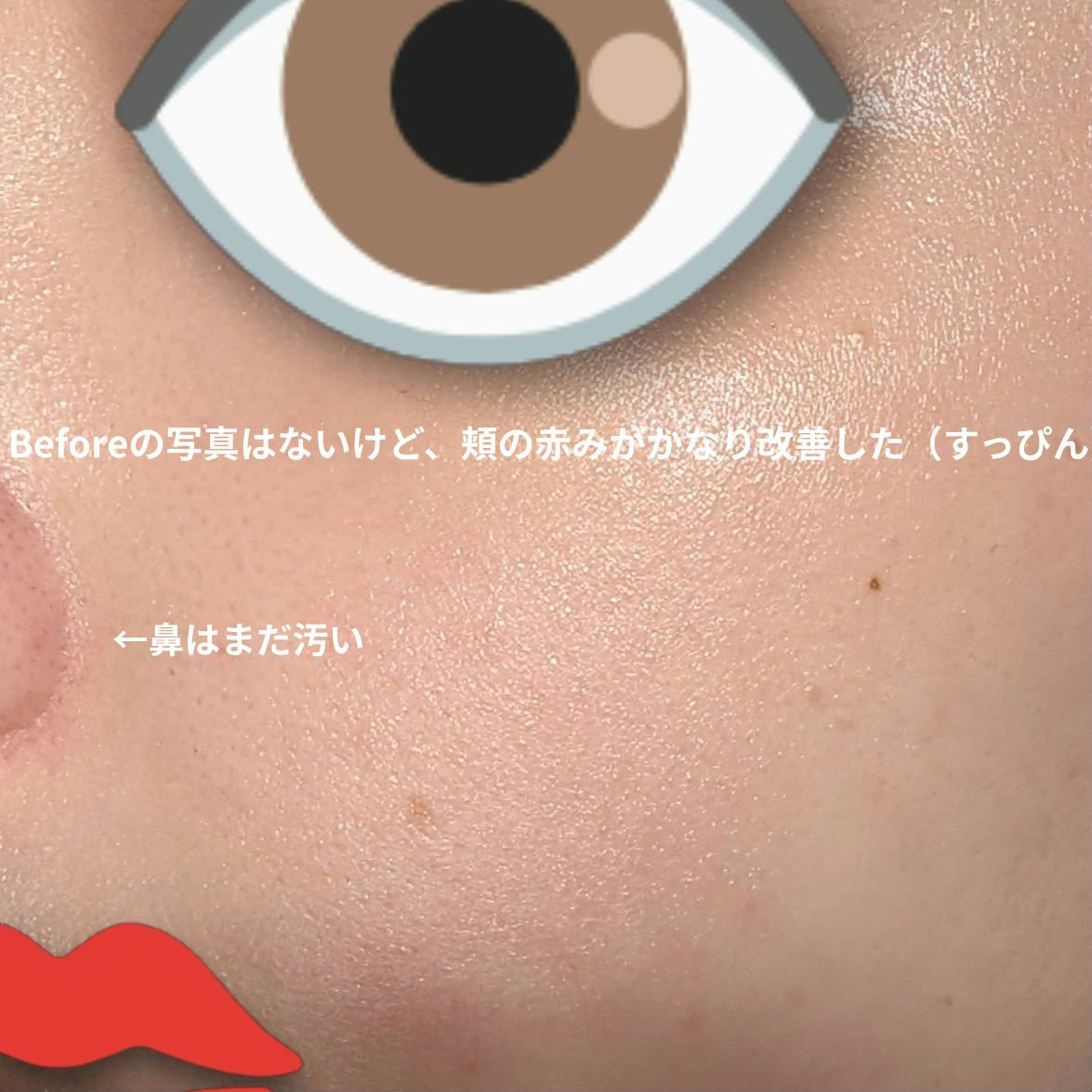 プロバイオシカ インテンシブ アンプル/SKIN1004/美容液を使ったクチコミ（2枚目）