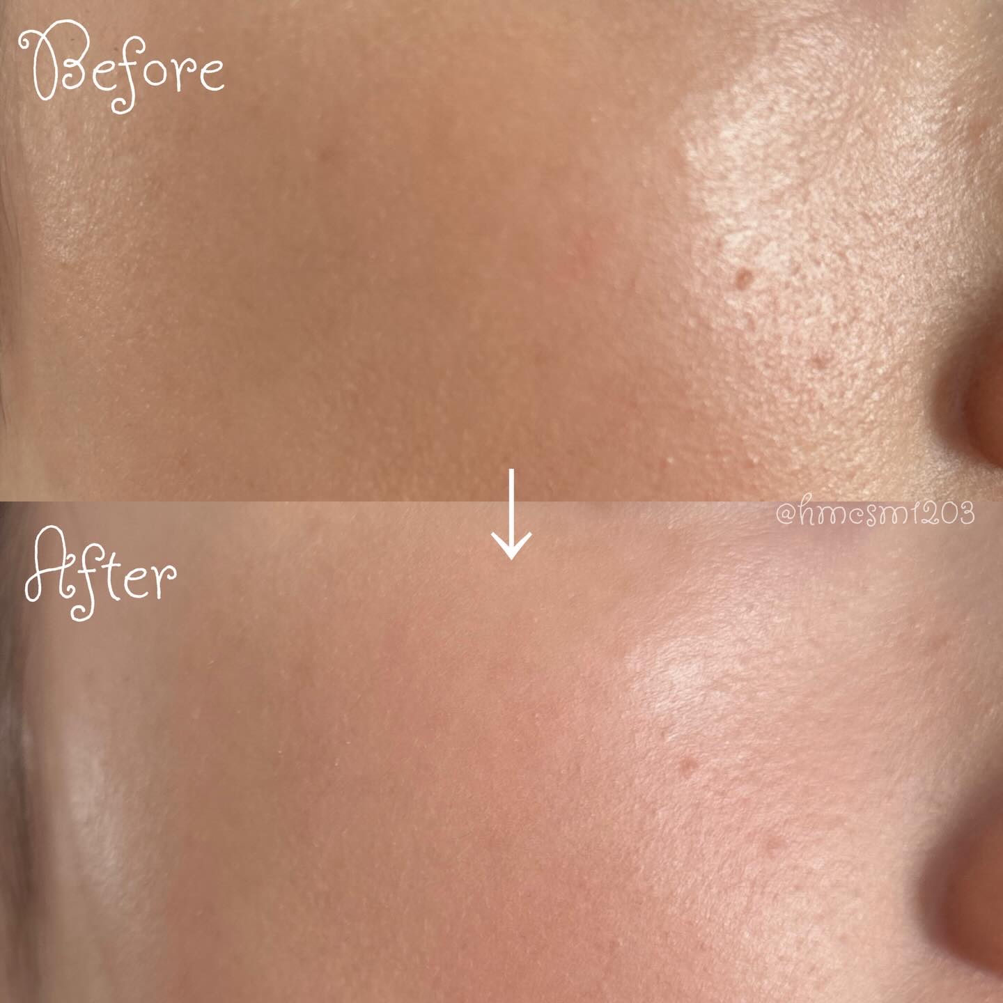 ライトリフレクティングセッティングパウダー　プレスト　N/NARS/プレストパウダーを使ったクチコミ（3枚目）