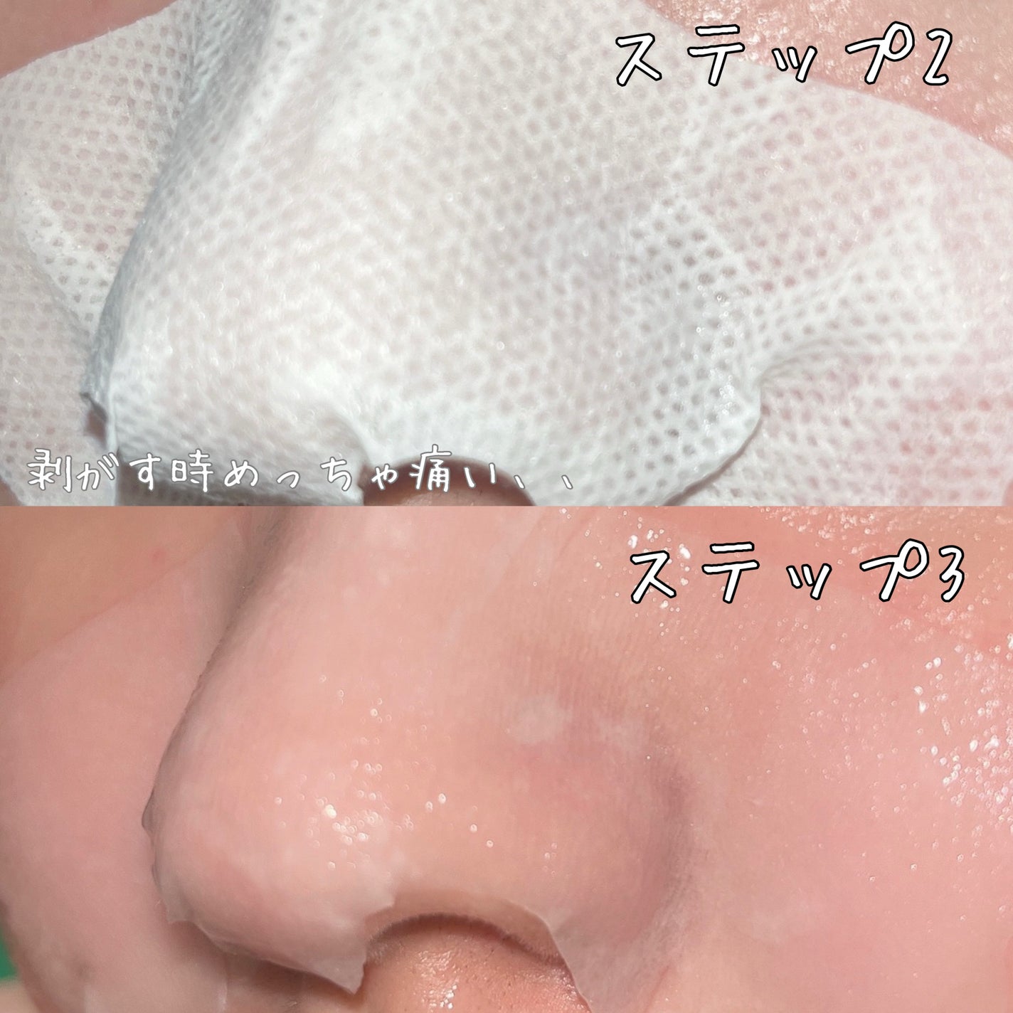 毛穴モップ (3STEP NOSE PACK)/YAMMY’S TOY/洗い流すパック・マスクを使ったクチコミ(2枚目)