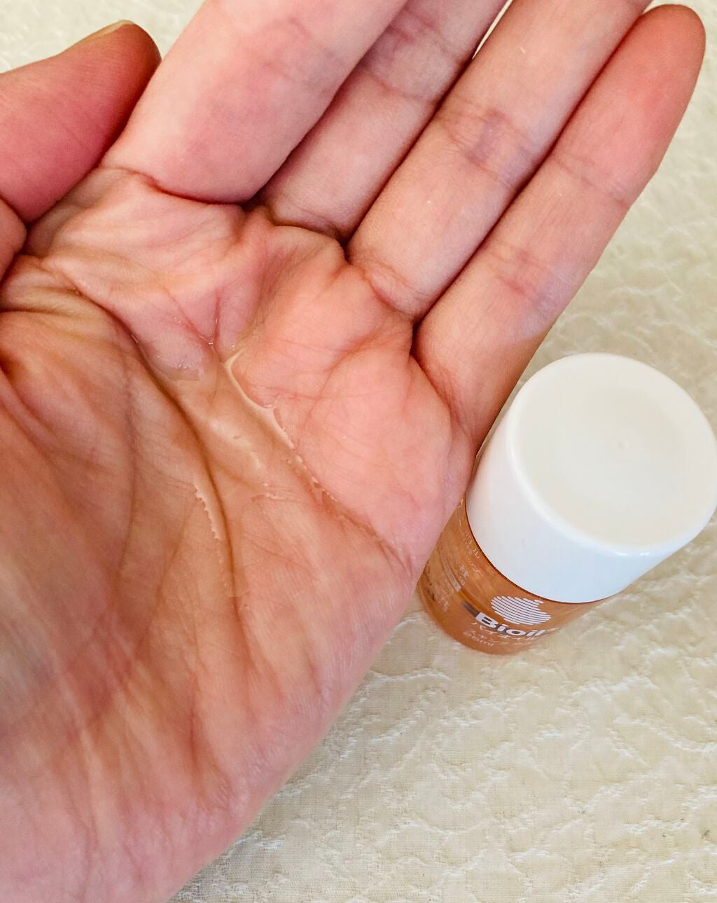 バイオイル/バイオイル/フェイスオイルを使ったクチコミ(3枚目)
