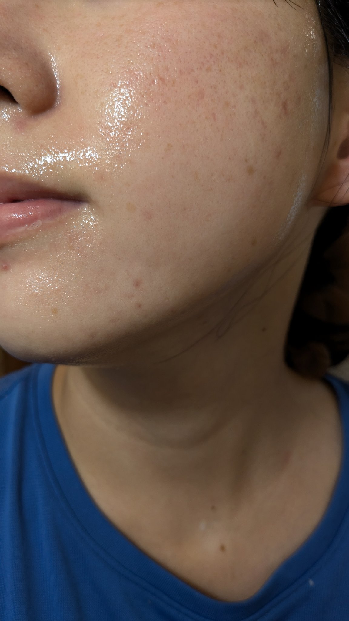 A2+NAG2ソリューション/The Ordinary/美容液を使ったクチコミ（2枚目）