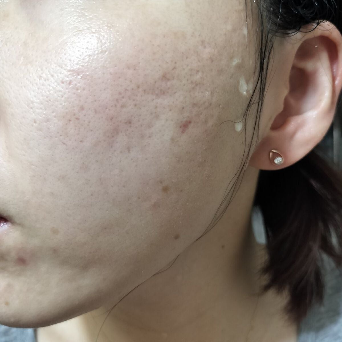 レチノールA 1% アドバンスドリバイタリゼーションクリーム/Life-flo/フェイスクリームを使ったクチコミ(2枚目)