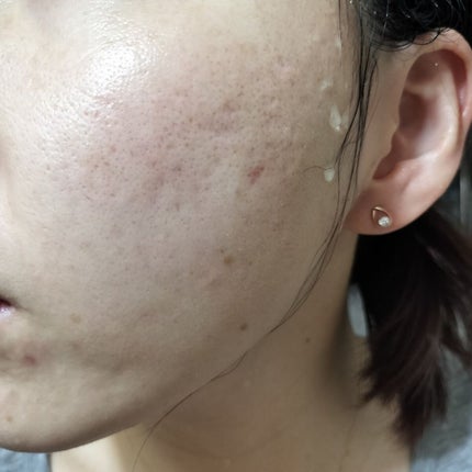 レチノールA 1% アドバンスドリバイタリゼーションクリーム/Life-flo/フェイスクリームを使ったクチコミ(2枚目)