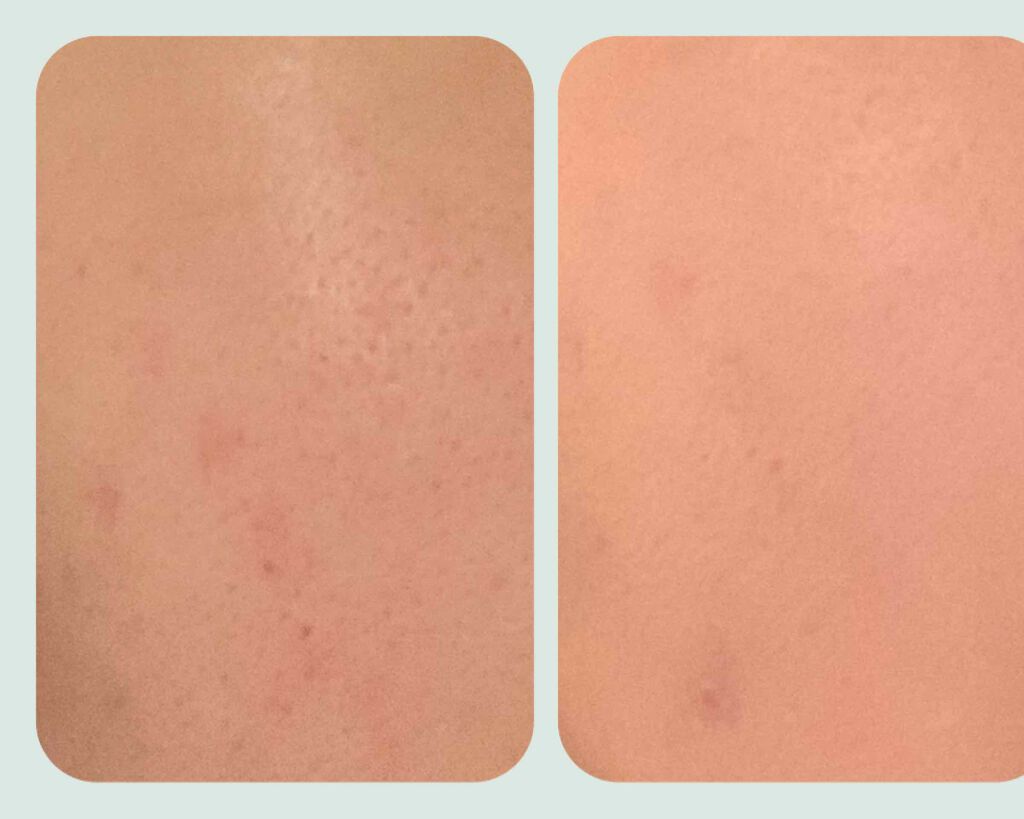 ミネラルBBクリーム NM（ナチュラルマット）/毛穴パテ職人/BBクリームを使ったクチコミ（2枚目）