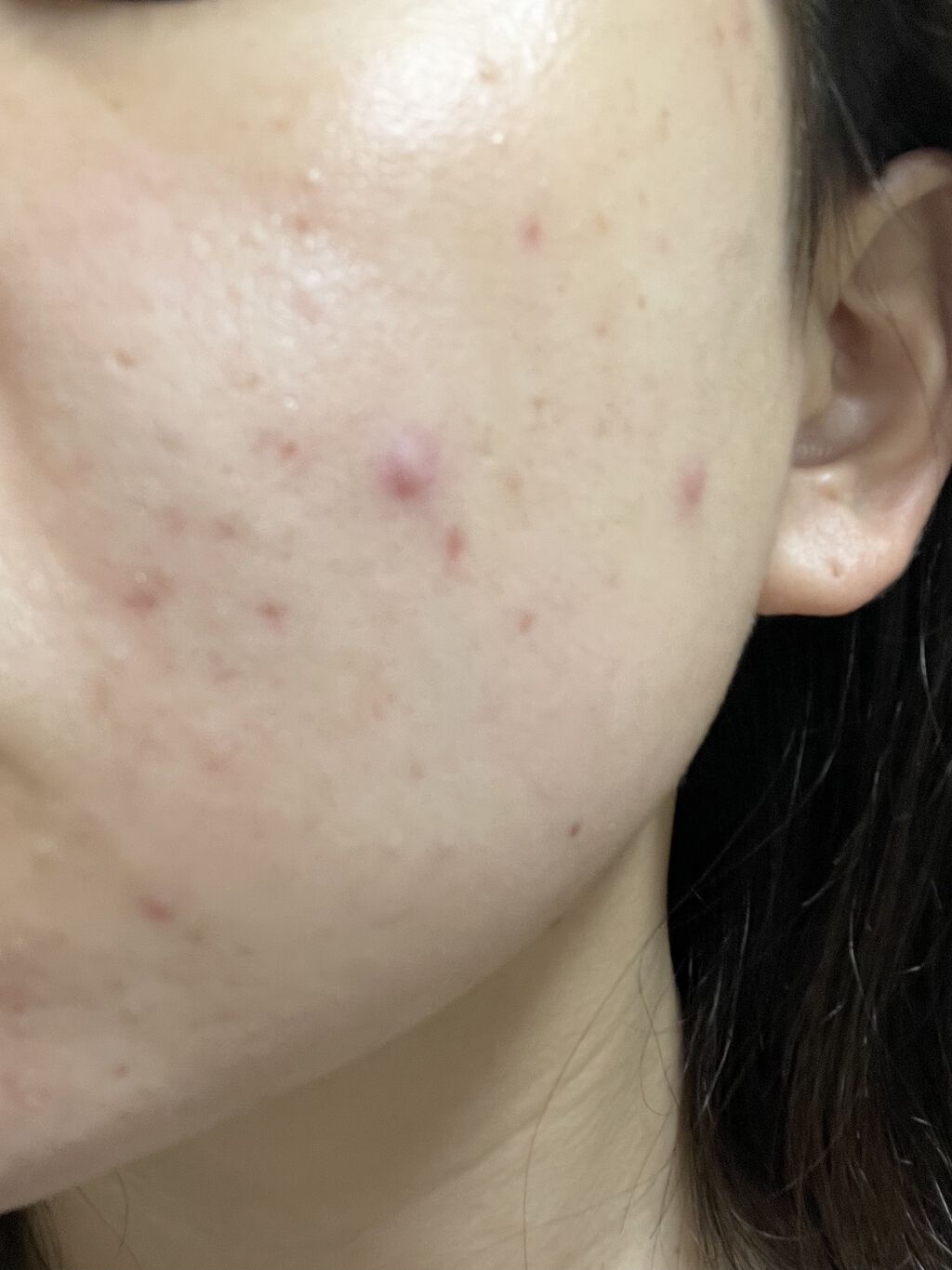 ハトムギ保湿ジェル(ナチュリエ スキンコンディショニングジェル)/ナチュリエ/美容液を使ったクチコミ（2枚目）