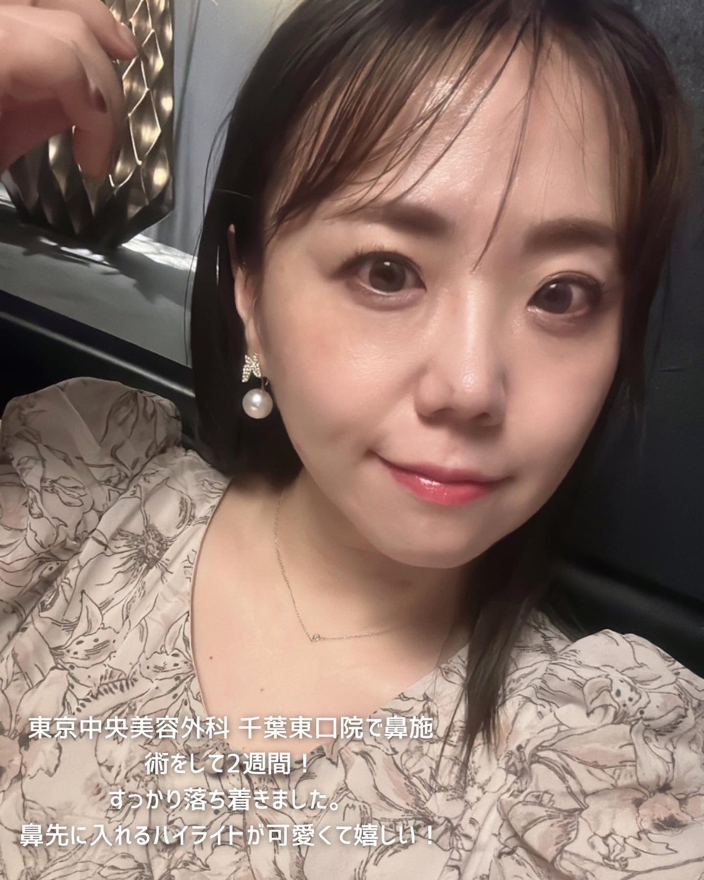 ちっちみ on LIPS 「👈他にも美容情報投稿してます💜𓂃𓈒𓏸𑁍𑁍𓏸𓈒𓂃東京中央..」(2枚目)