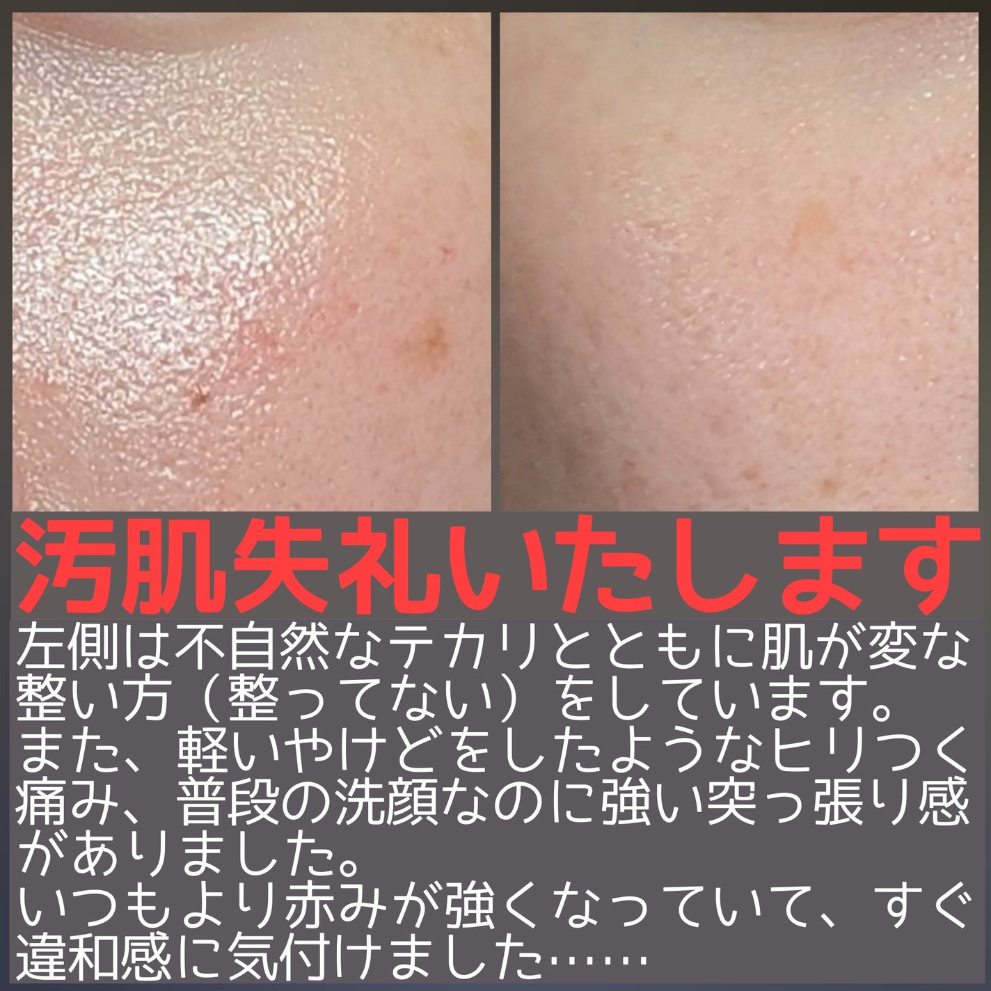 エリクシール ホワイト スポットクリアセラム WT/エリクシール/美容液を使ったクチコミ(4枚目)