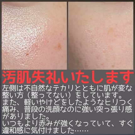 エリクシール ホワイト スポットクリアセラム WT/エリクシール/美容液を使ったクチコミ(4枚目)