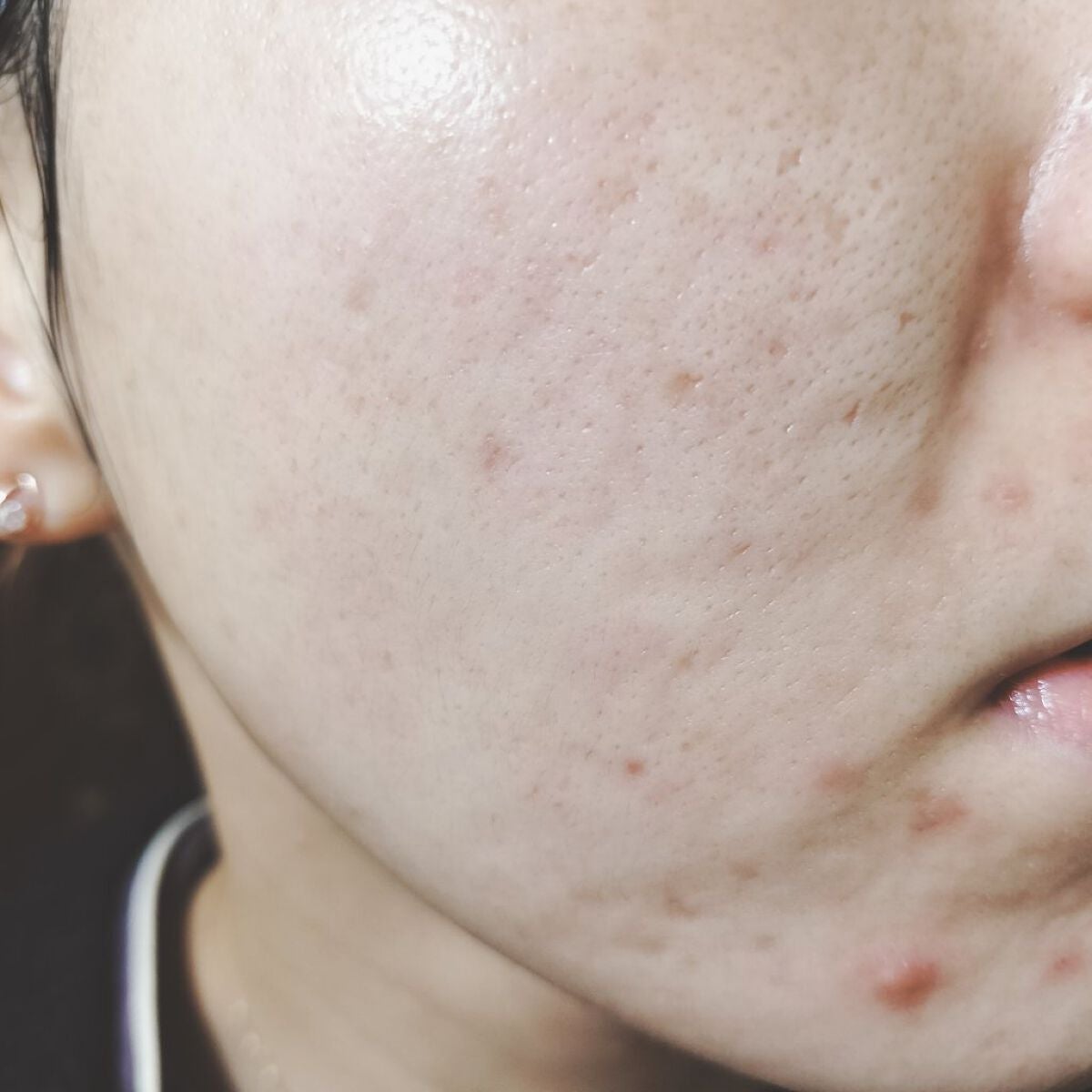 miina@汚肌工事録⚠️ on LIPS 「✍11/27㈰の#汚肌工事録27〜29は帰省&旅行でみだれまく..」(1枚目)