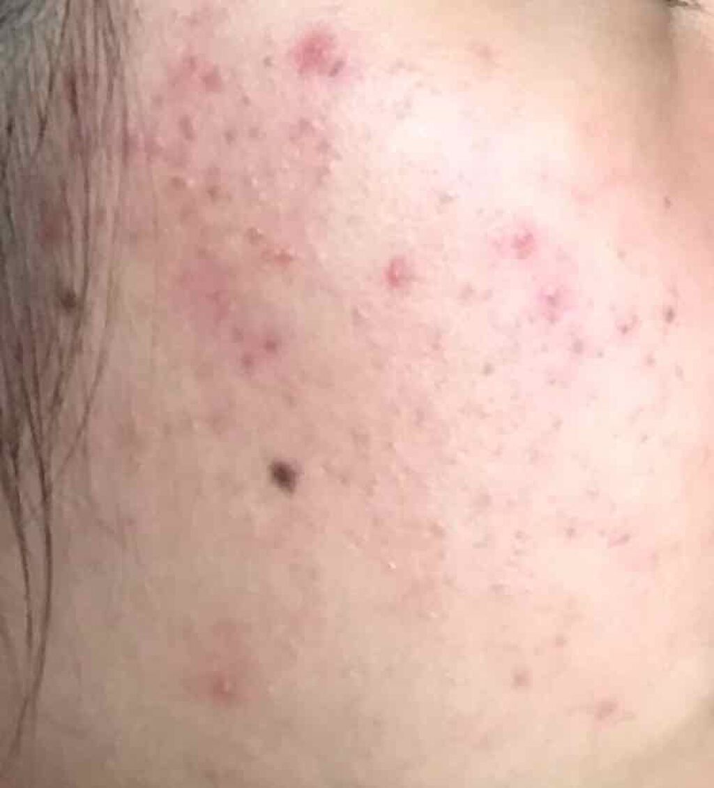 薬用保湿化粧水/オードムーゲ/化粧水を使ったクチコミ（3枚目）