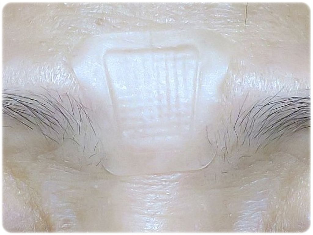 ミケンディープパッチ/北の快適工房/シートマスク・パックを使ったクチコミ(4枚目)