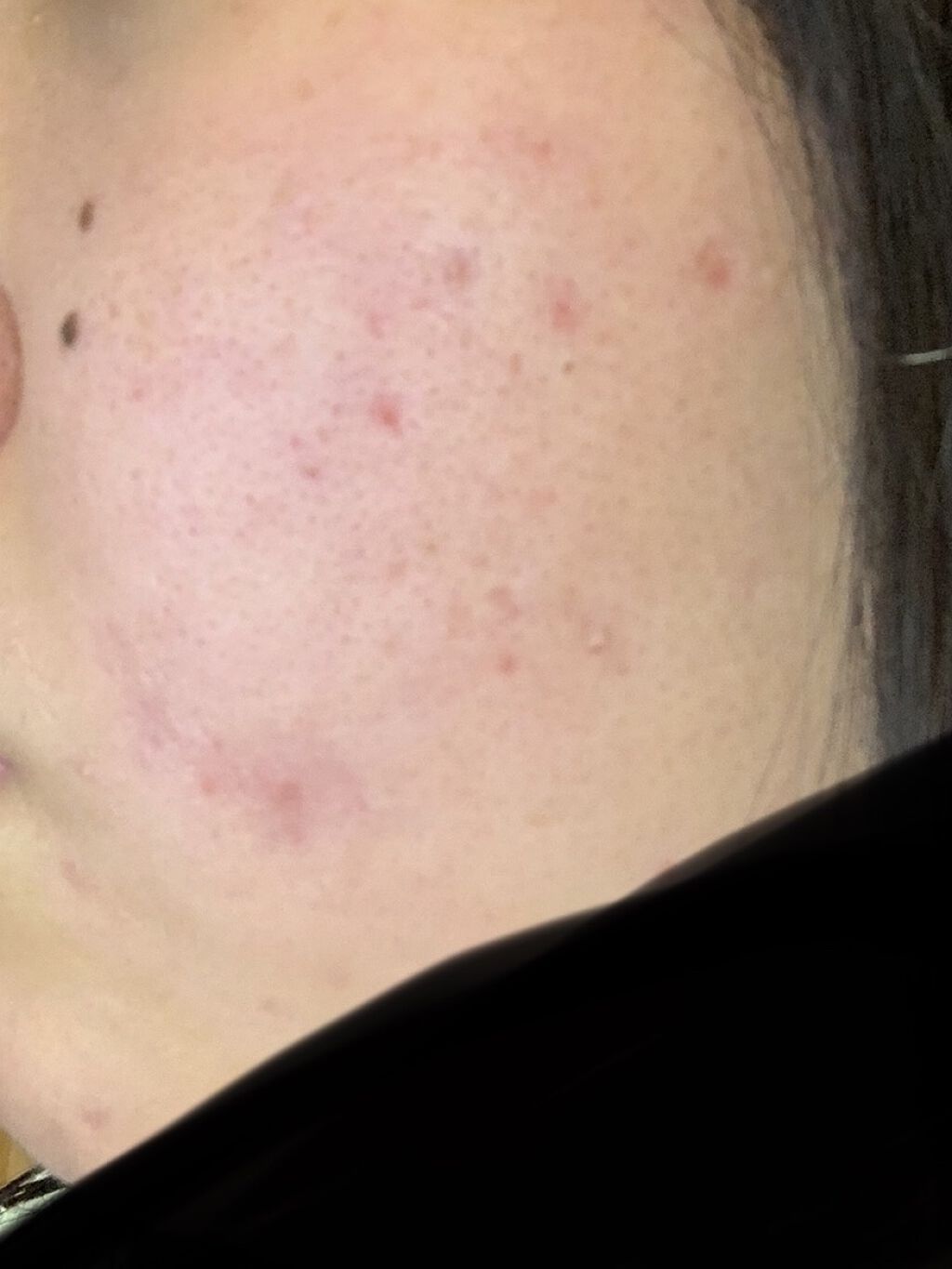 ハトムギ保湿ジェル(ナチュリエ スキンコンディショニングジェル)/ナチュリエ/美容液を使ったクチコミ（2枚目）