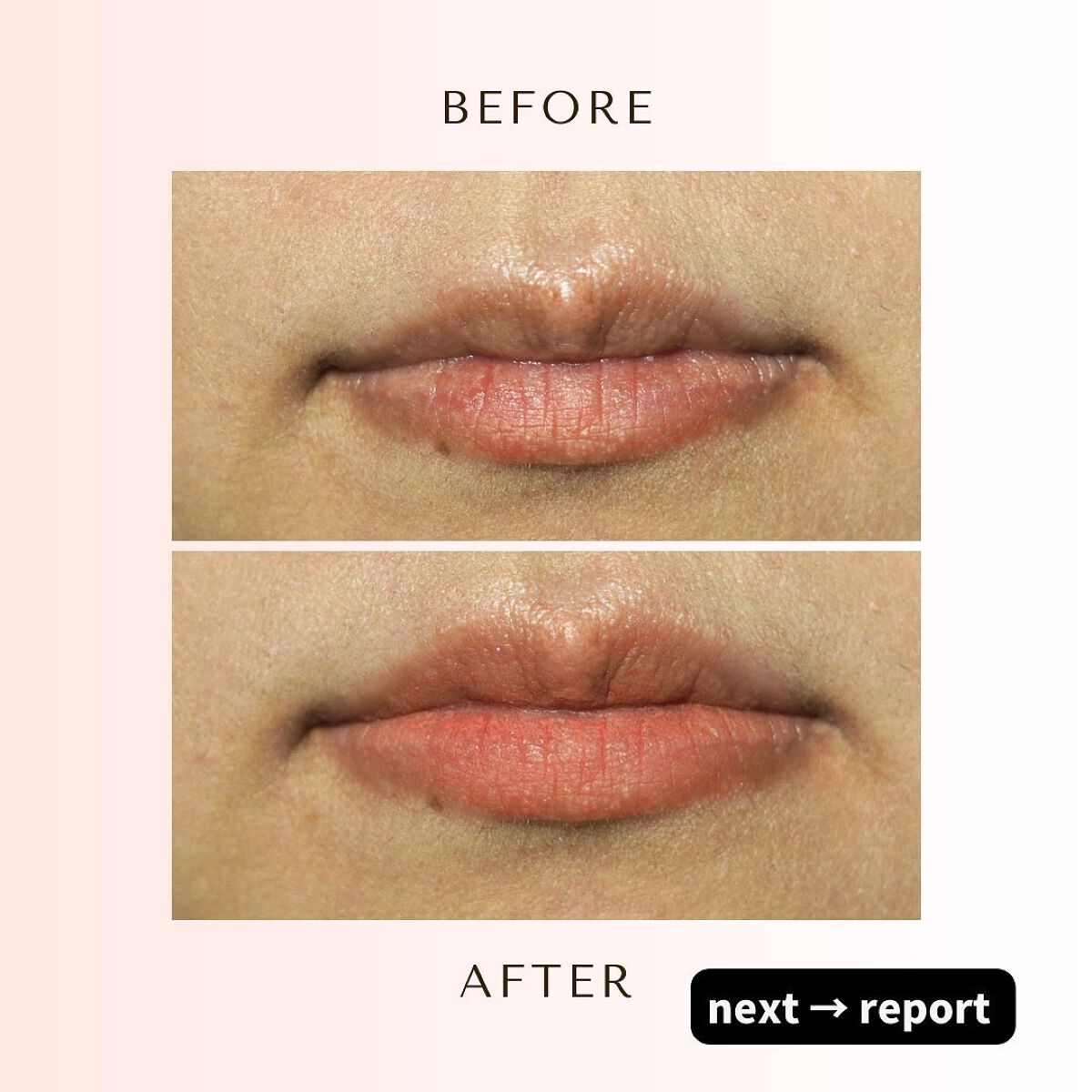 むっちリップ/b idol/口紅を使ったクチコミ(2枚目)