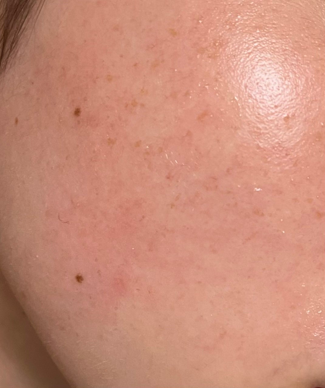 ããðŒ on LIPS ããã®èã£ãŠæããããããŸããðãã°ããïŒã¯ãããšããŠãèã®èµ€ã¿..ãïŒ1æç®ïŒ