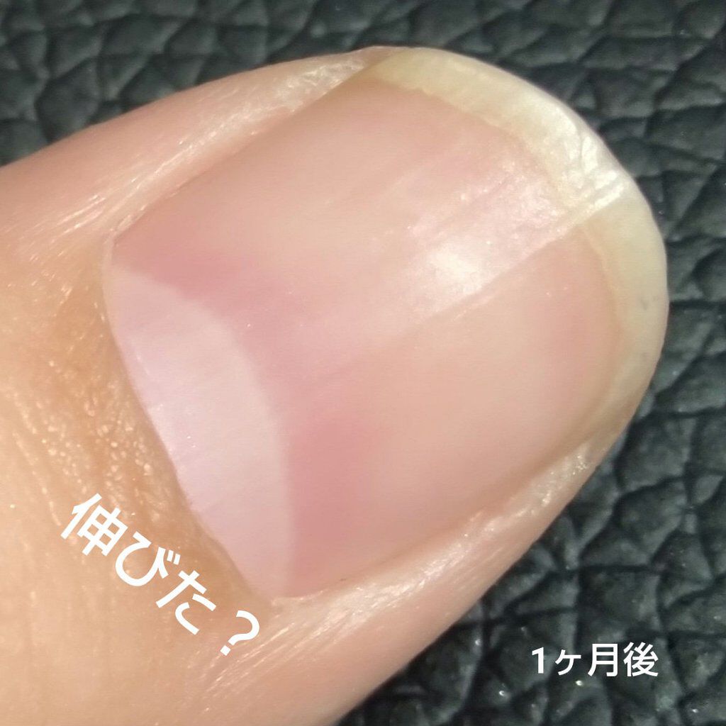 オリジナル ピュアスキンジェリー/ヴァセリン/ボディクリームを使ったクチコミ（2枚目）