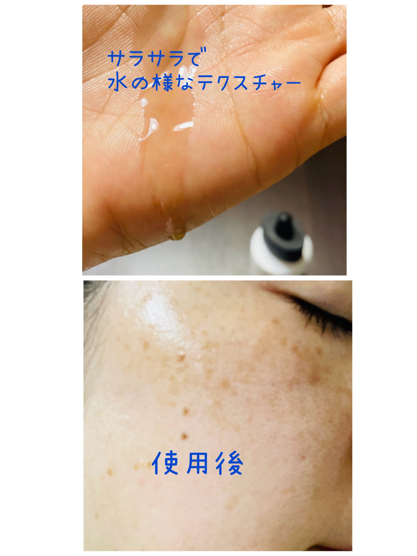 RXザ・アルファアルブチン2 ニキビ跡ケアセラム/COSRX/美容液を使ったクチコミ(2枚目)