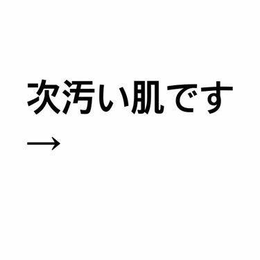 ペアアクネクリームW(医薬品)/ペア/その他スキンケアグッズを使ったクチコミ（1枚目）